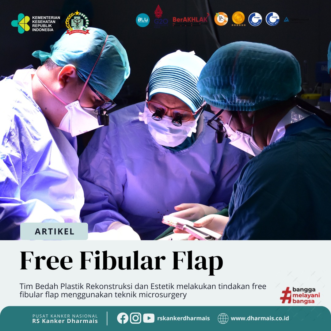 Free Fibular Flap